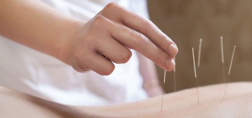 иглоукалывание для похудения