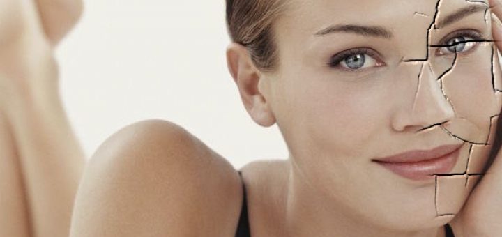 Сухость кожи