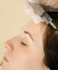 Мезотерапия для волос