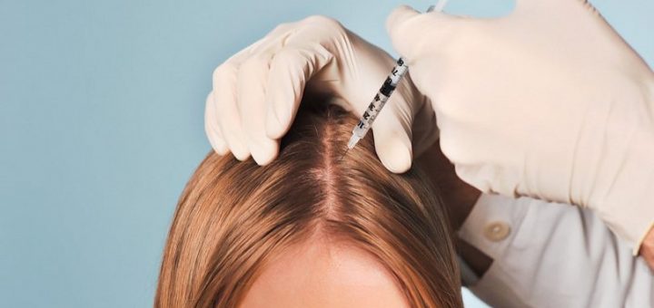Мезотерапия волос