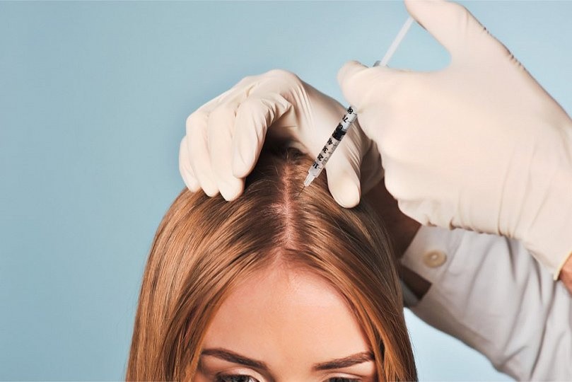 Мезотерапия волос