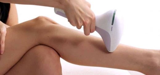 фотоэпиляция