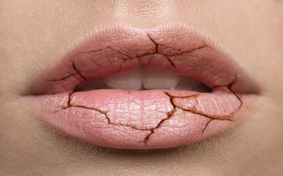 сохнут губы