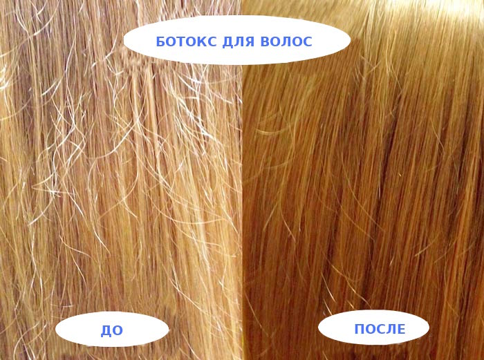 результат применения ботокса для волос