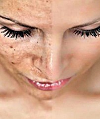 домашнее отбеливание лица