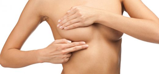 Подтяжка груди нитями