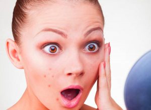 Прыщи в подростковом возрасте