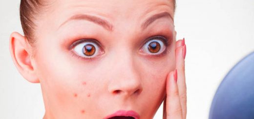 Прыщи в подростковом возрасте