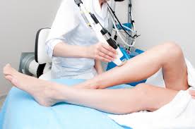 лазерная эпиляция