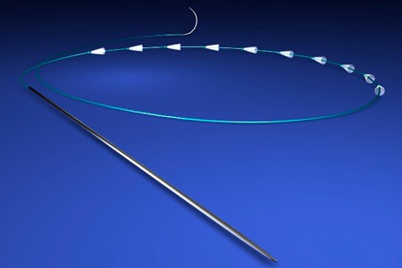 Нити для подтяжки груди