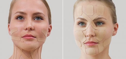 кинезиотейпирование лица