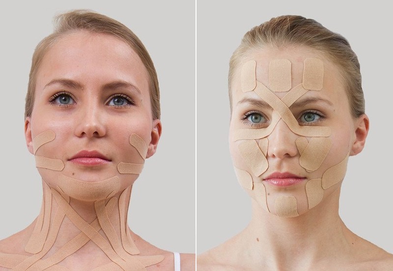 кинезиотейпирование лица