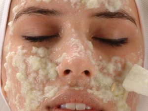 Хлористый пилинг