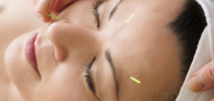 Акупунктурный лифтинг