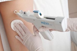 инъекционная мезотерапия