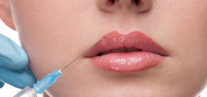 Мнъекционная пластика губ