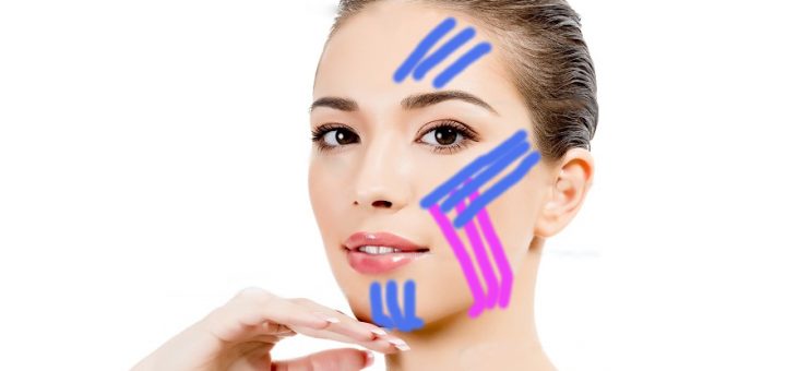 кинейзотейпирование лица