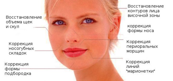 Зоны для филеров