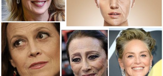 мелкоморщинистый тип старения