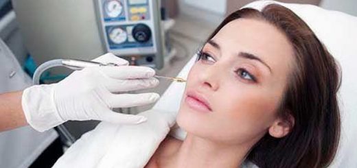 криоэлектрофорез