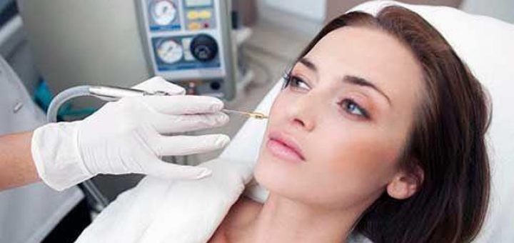 криоэлектрофорез