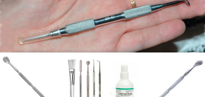 Ложка Уно и петля Видаля