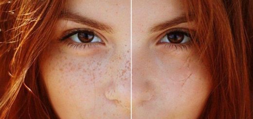 удаляем веснушки домашними средствами
