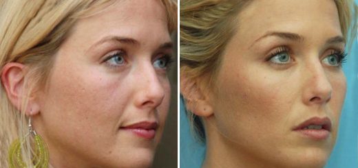 Коррекция овала лица. Простые домашние способы