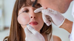 Прыщ на лице